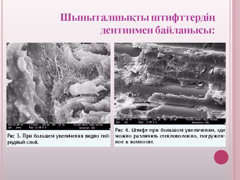 Шыныталшықты штифттердің дентинмен байланысы: